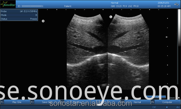 image for labtop ultrasound